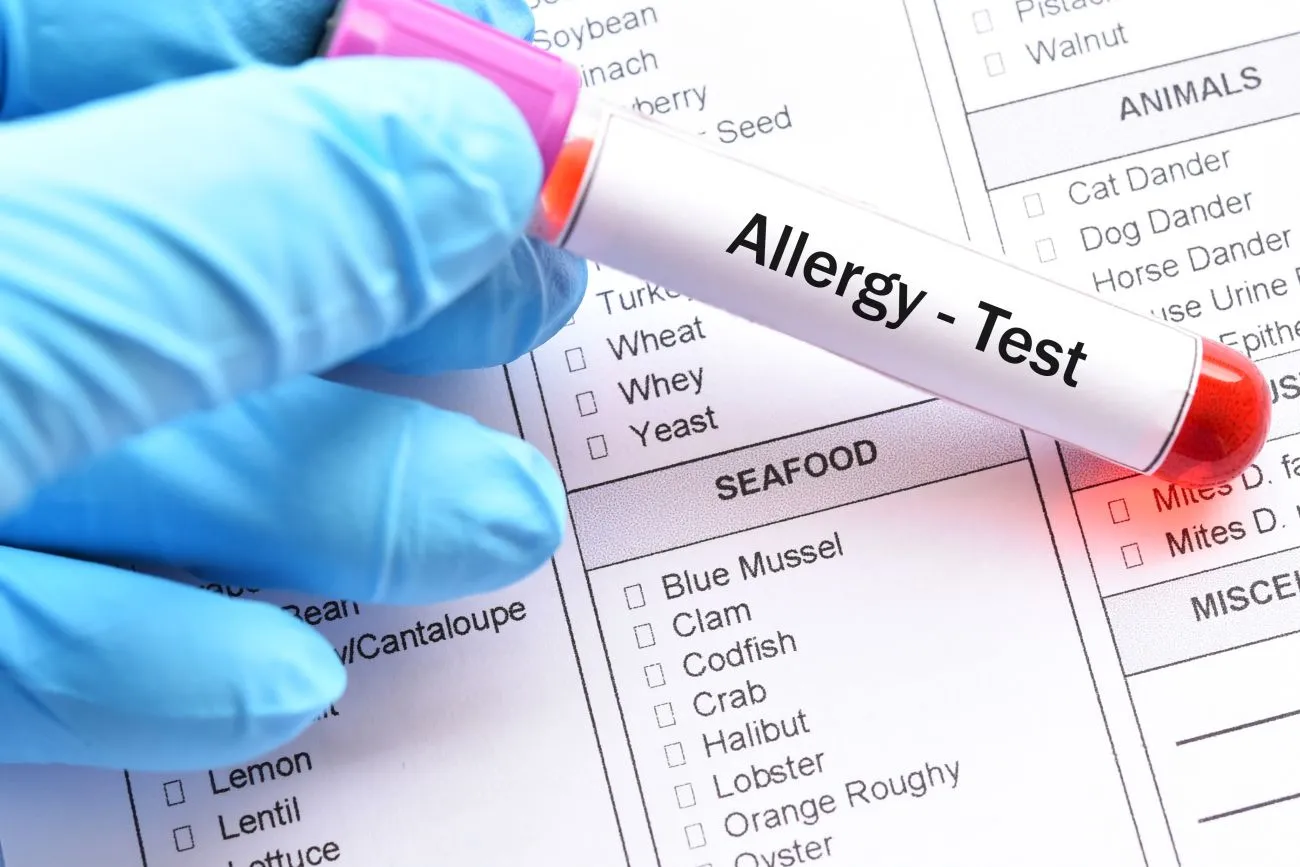 Everything You Need to Know About Food Sensitivity Tests