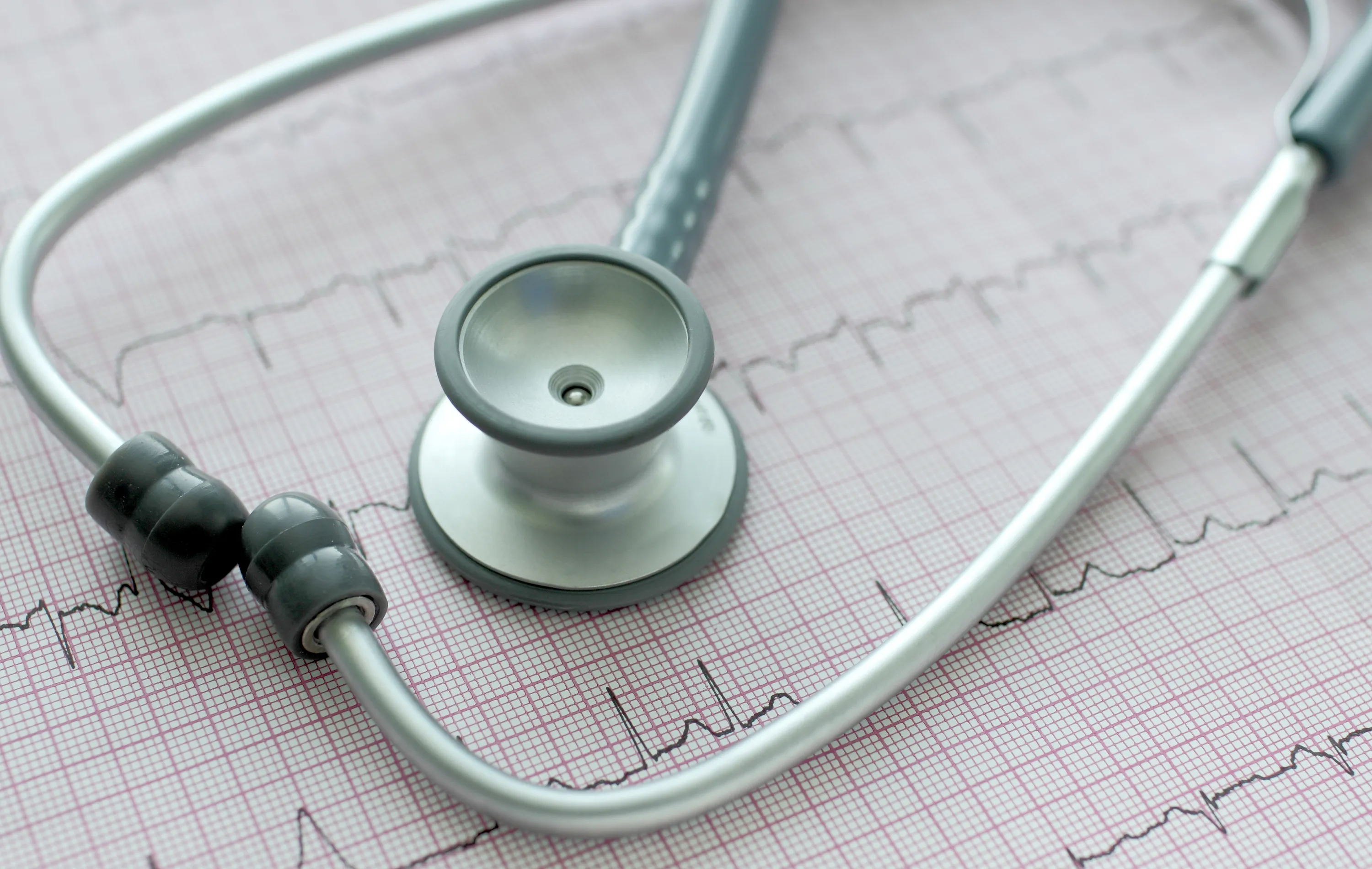 Do You Know the Early Signs of Atrial Fibrillation?