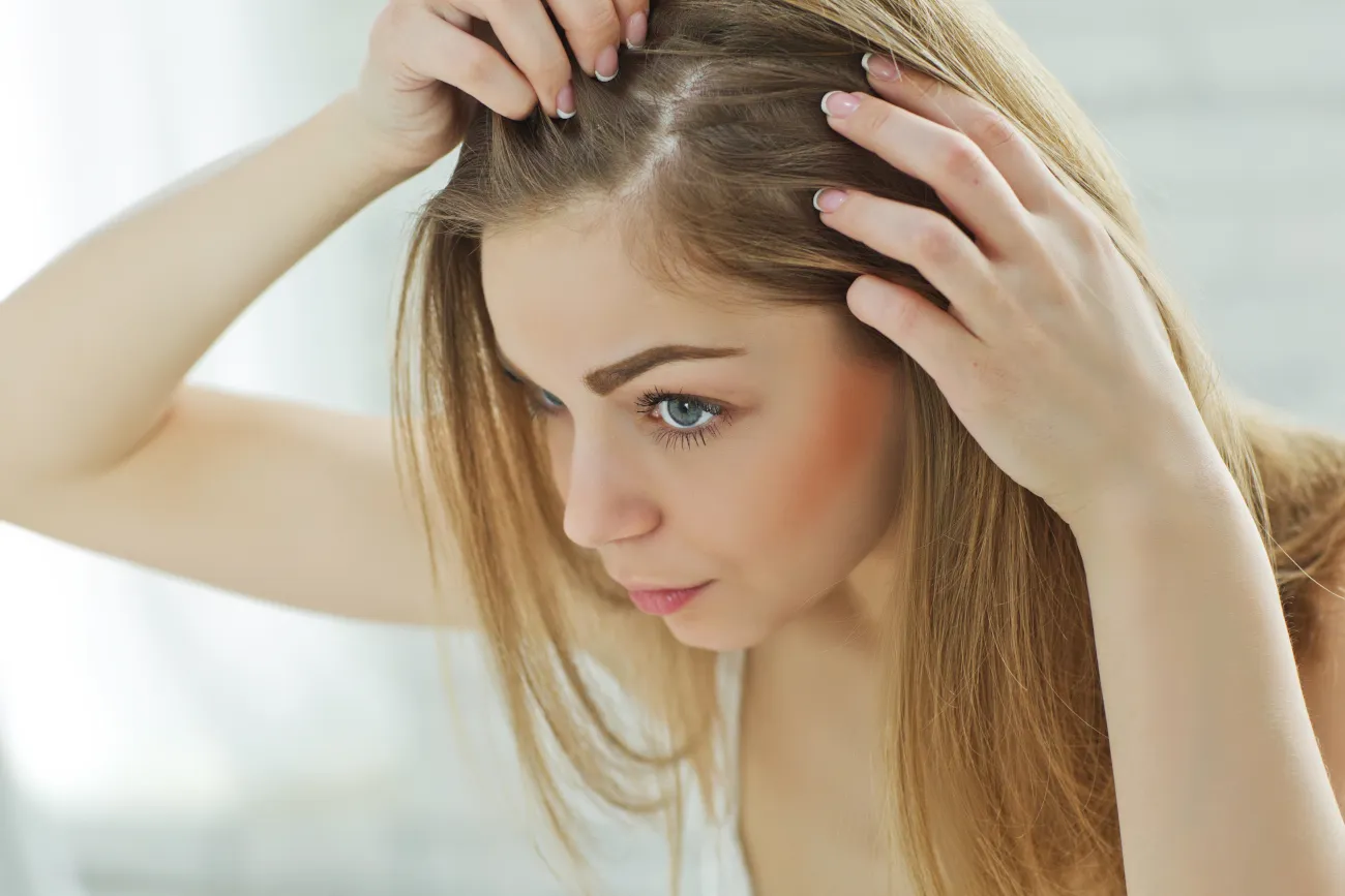 Hair Loss Treatment for Women: Top Home Solutions to Reclaim Your Locks