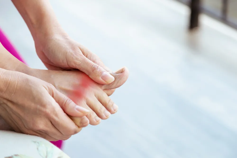 Common Gout Symptoms You Shouldn’t Ignore