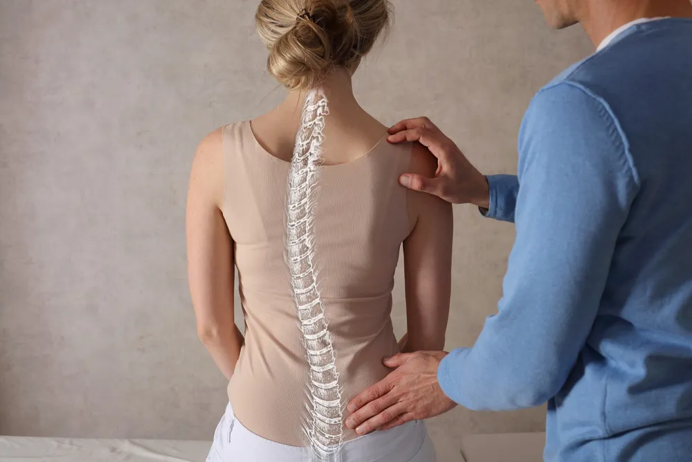 Everything You Need to Know About Scoliosis