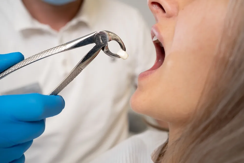 Exploring Same-Day Tooth Extraction Options with Minimal Cost