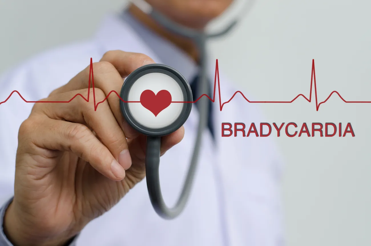 Bradycardia Signs and Symptoms: What You Need to Know