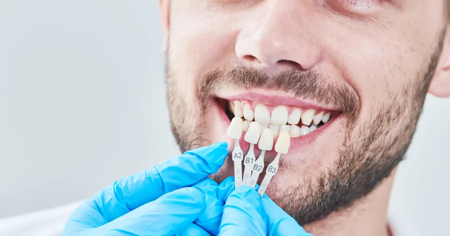 Low-Cost Dental Implants: Affordable Options to Restore Your Smile
