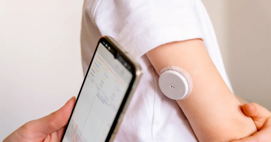 Revolutionize Diabetes Management with Continuous Glucose Monitors