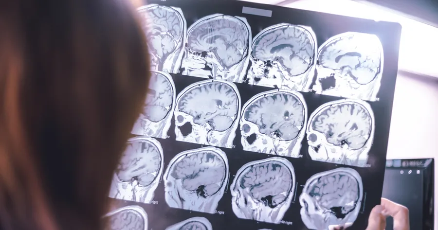 Brain Gains: Your Guide to Participating in Neurology Clinical Trials