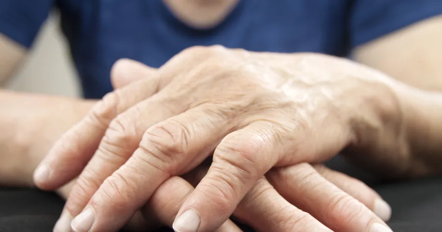 What You Need to Know About Rheumatoid Arthritis Symptoms and Treatment