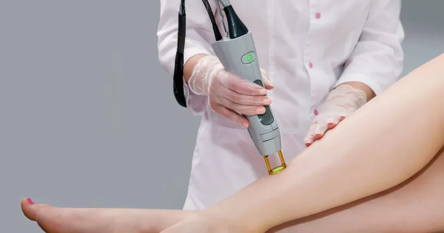 Laser Hair Removal Is Easier Than Ever