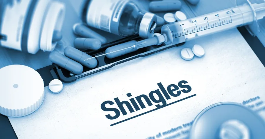 Everything You Need to Know About Shingles