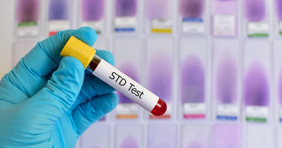 4 Reasons Everyone Should Get Tested for STDs