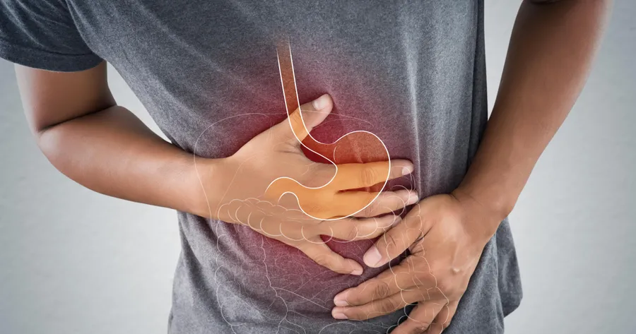 The Signs and Symptoms of Crohn’s Disease