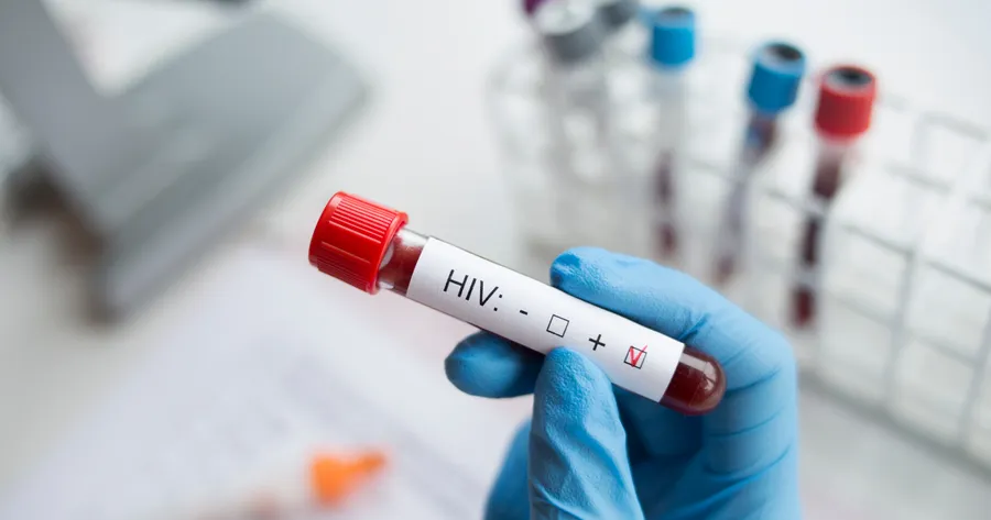 HIV: Symptoms, Risk Factors and Treatment