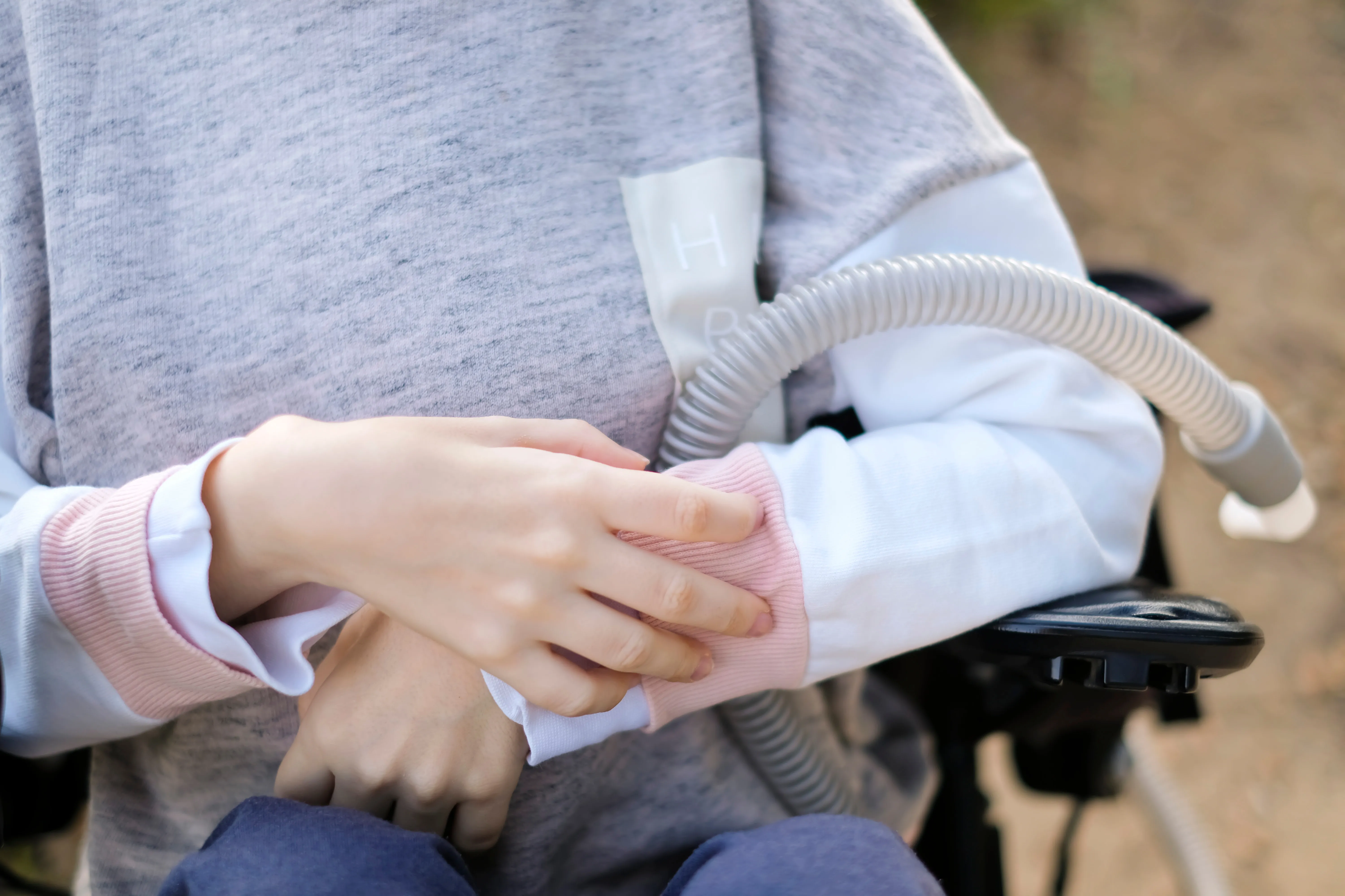 Adult Onset Spinal Muscular Atrophy: Knowing the Symptoms and Treatments