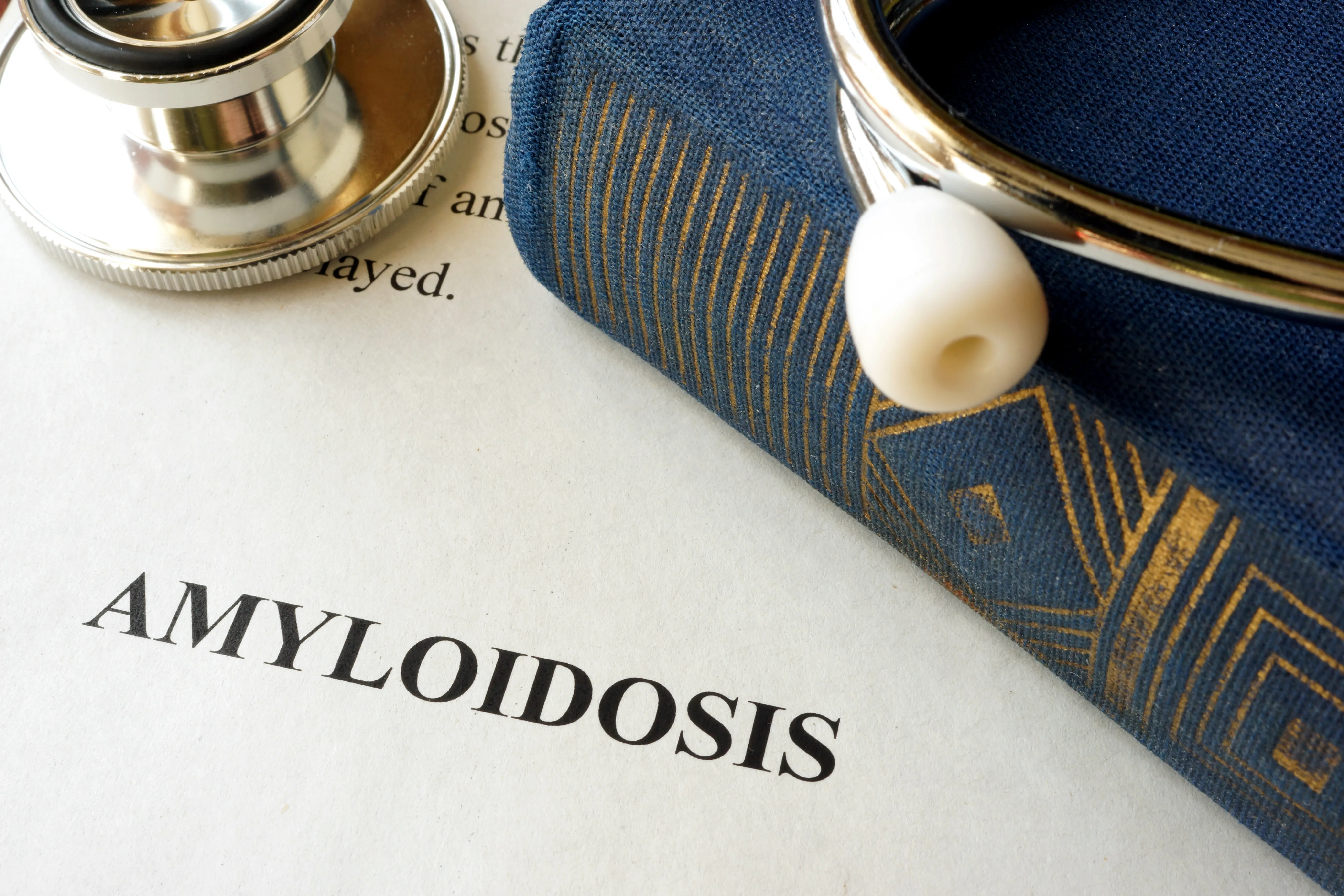 Amyloidosis: Symptoms and Treatment Options Everyone Should Know