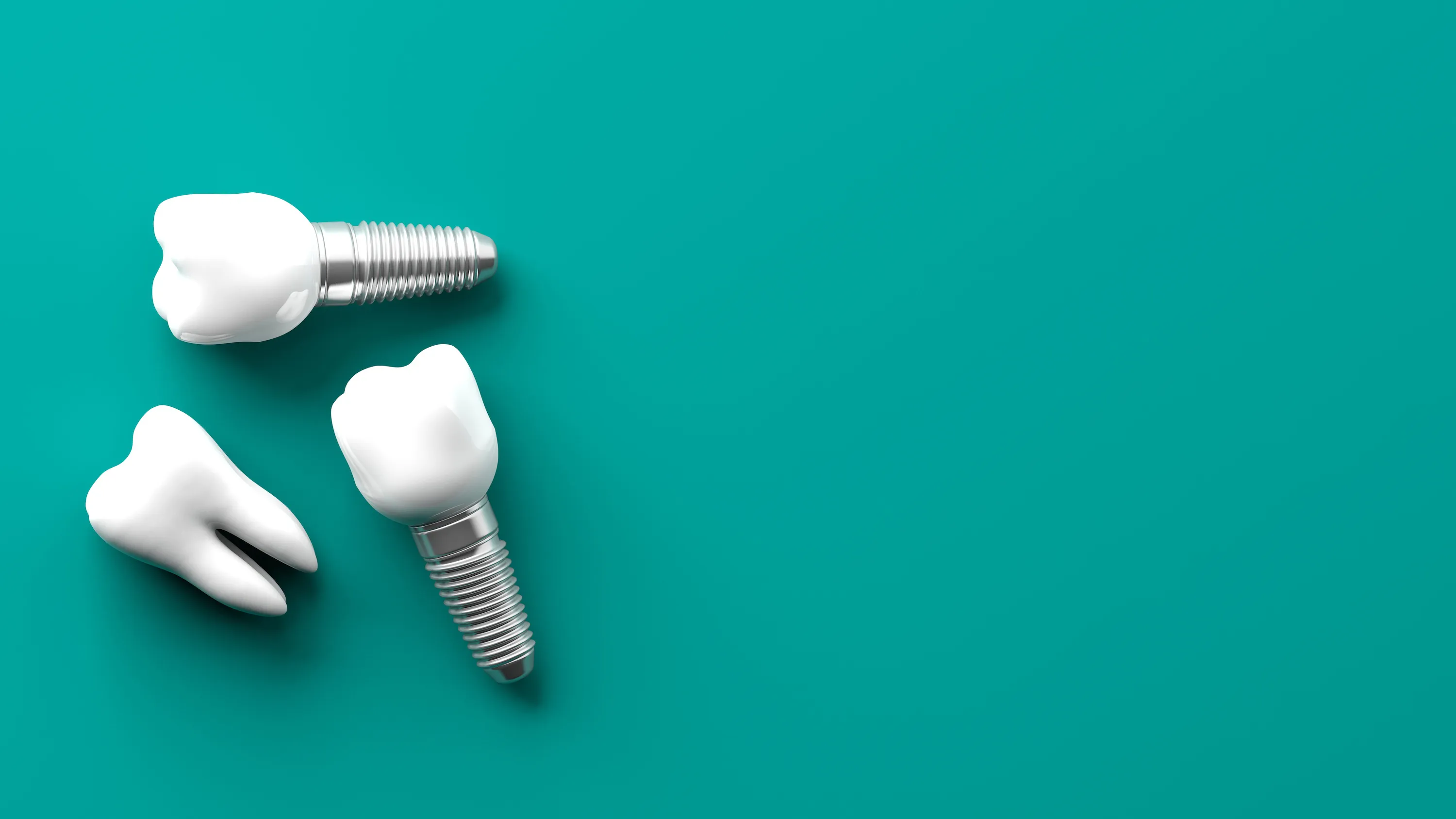 Free Dental Implants: Facts, Myths, and How to Get Them