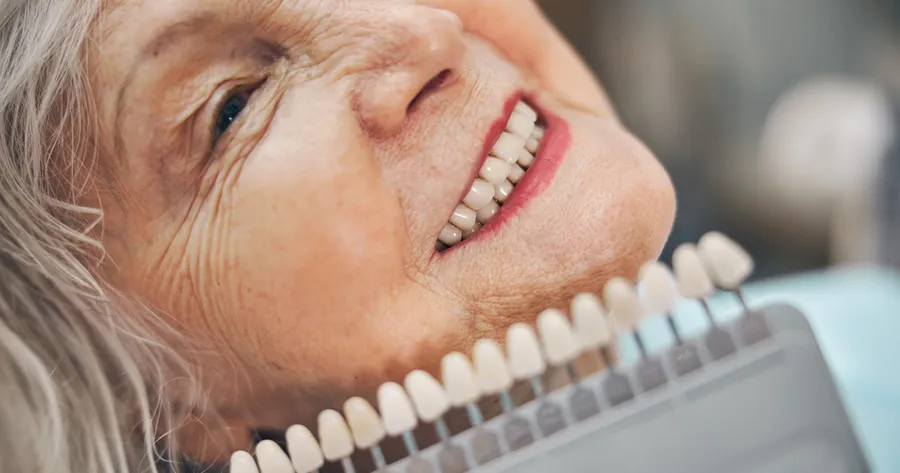 Amazing Savings: How Seniors Can Get the Best Deals on Dental Implants