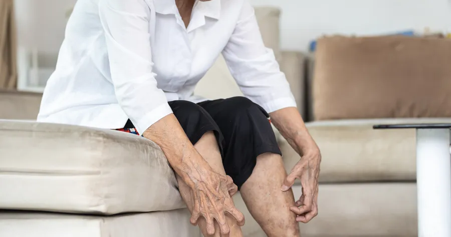 Why Seniors Shouldn’t Ignore These Atopic Dermatitis Signs