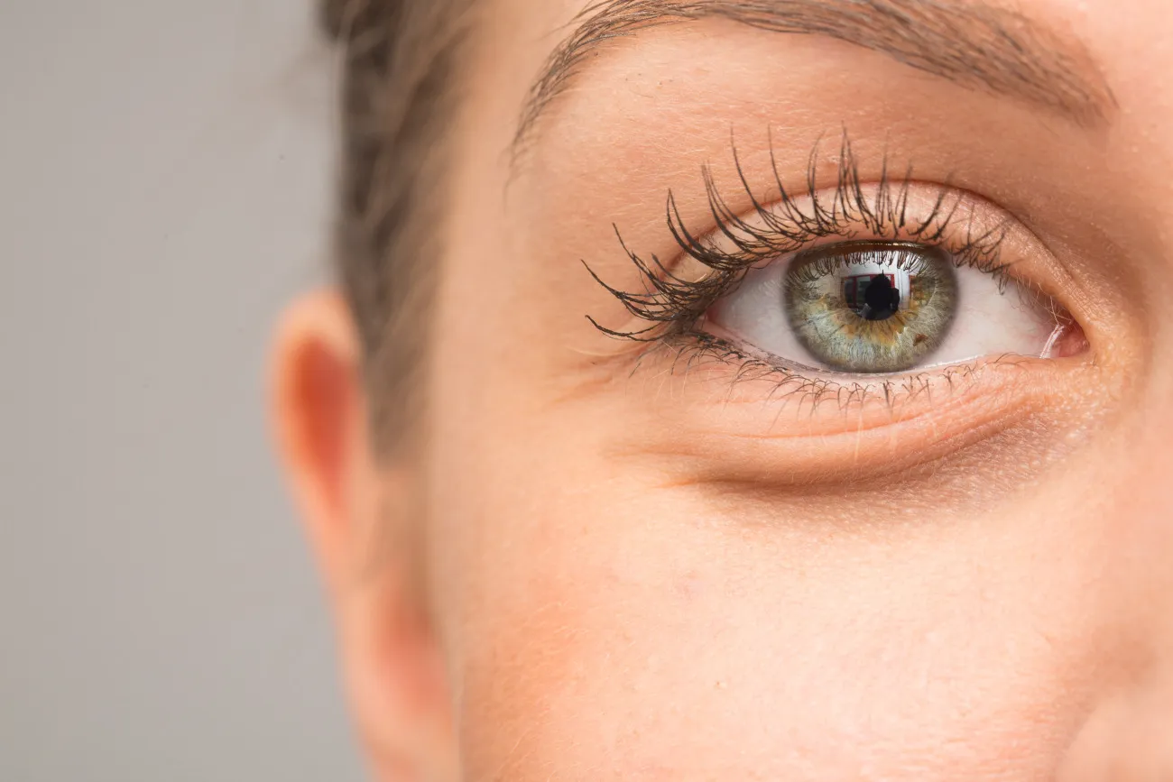 Say Goodnight to Tired Eyes: How Xeomin Can Transform Undereye Bags