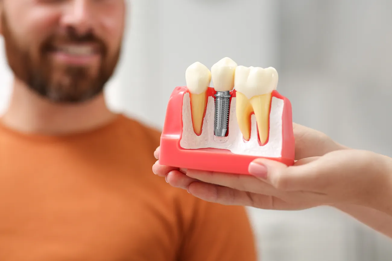 The Many Benefits of Same-Day Tooth Replacement