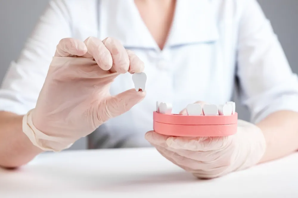 Understanding Different Tooth Replacement Options for Dental Restoration