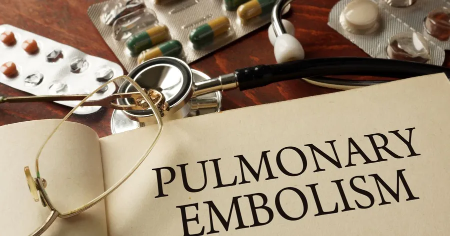 How to Recognize the Symptoms of Pulmonary Embolism