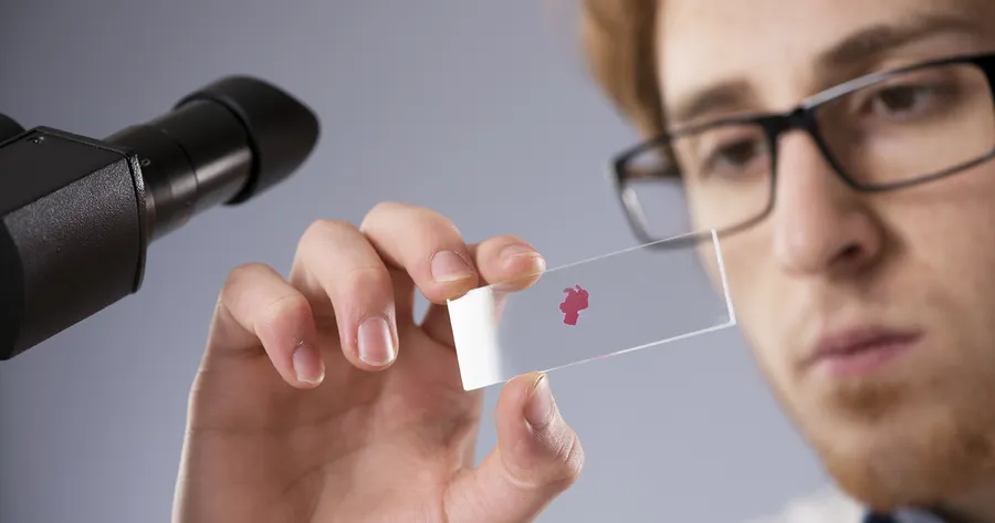 Is there a blood test for depression?