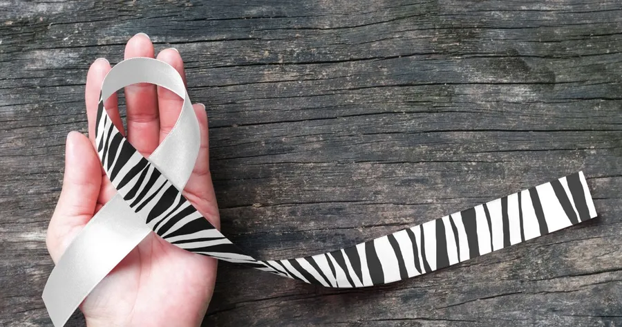 Spotting the Subtle Signs of Carcinoid Syndrome