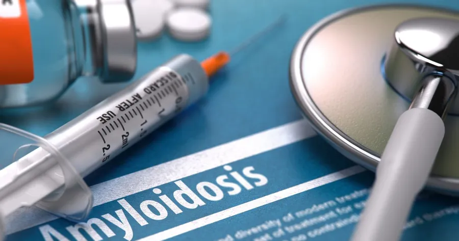 Recognizing the Subtle Symptoms of Amyloidosis