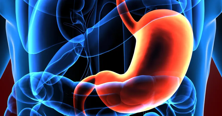 The Signs and Symptoms of Gastric Cancer