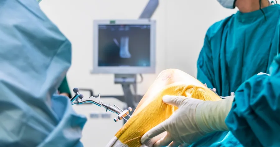 Robotic Knee Replacement: Precision, Recovery, Longevity