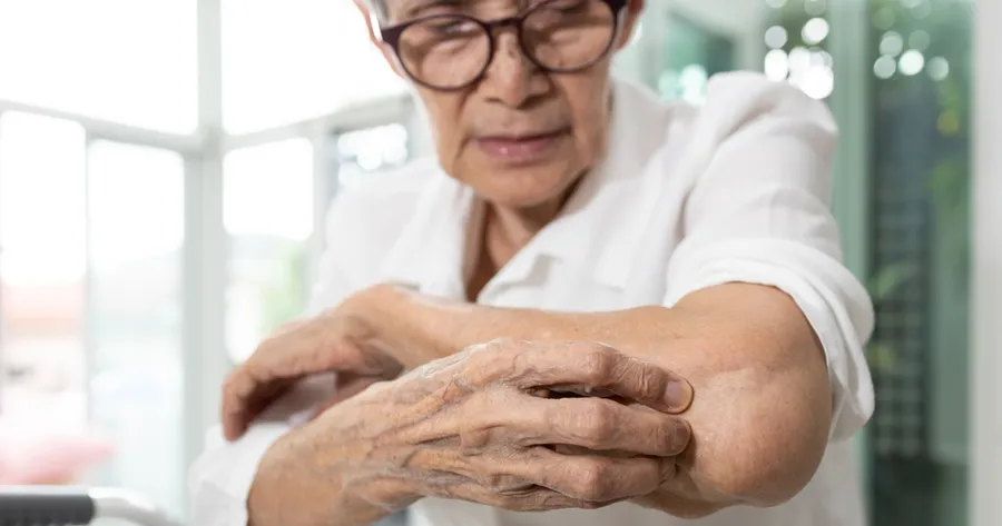 Atopic Dermatitis in Seniors: Symptoms You Can’t Afford to Overlook