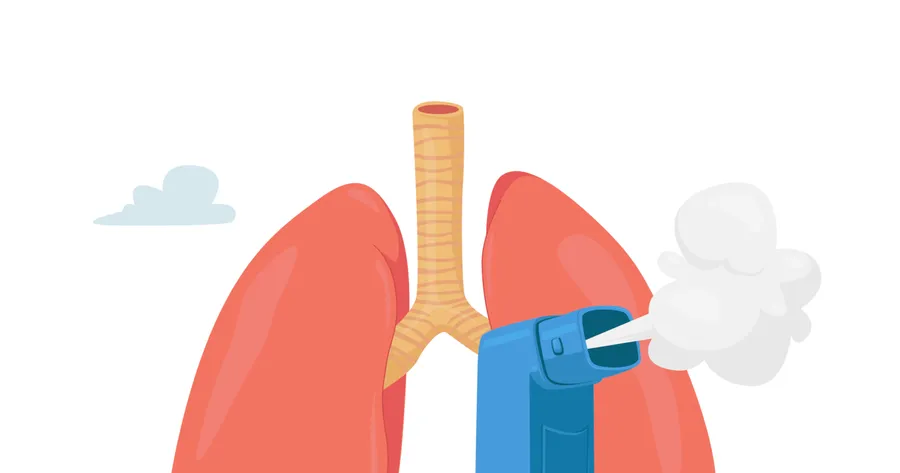 Asthma: Symptoms, Triggers, and Treatment Options
