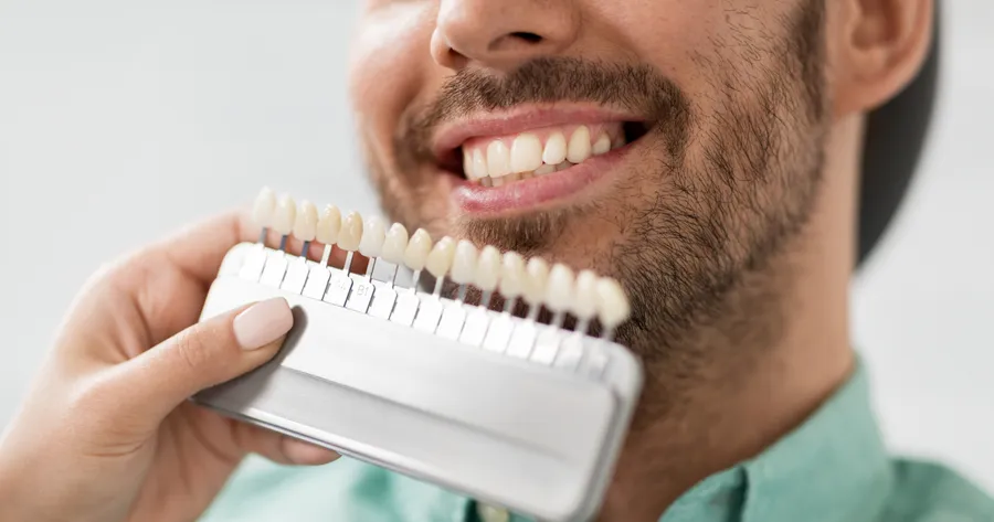 Dental Veneers 101: Exploring the Benefits Beyond the Aesthetics