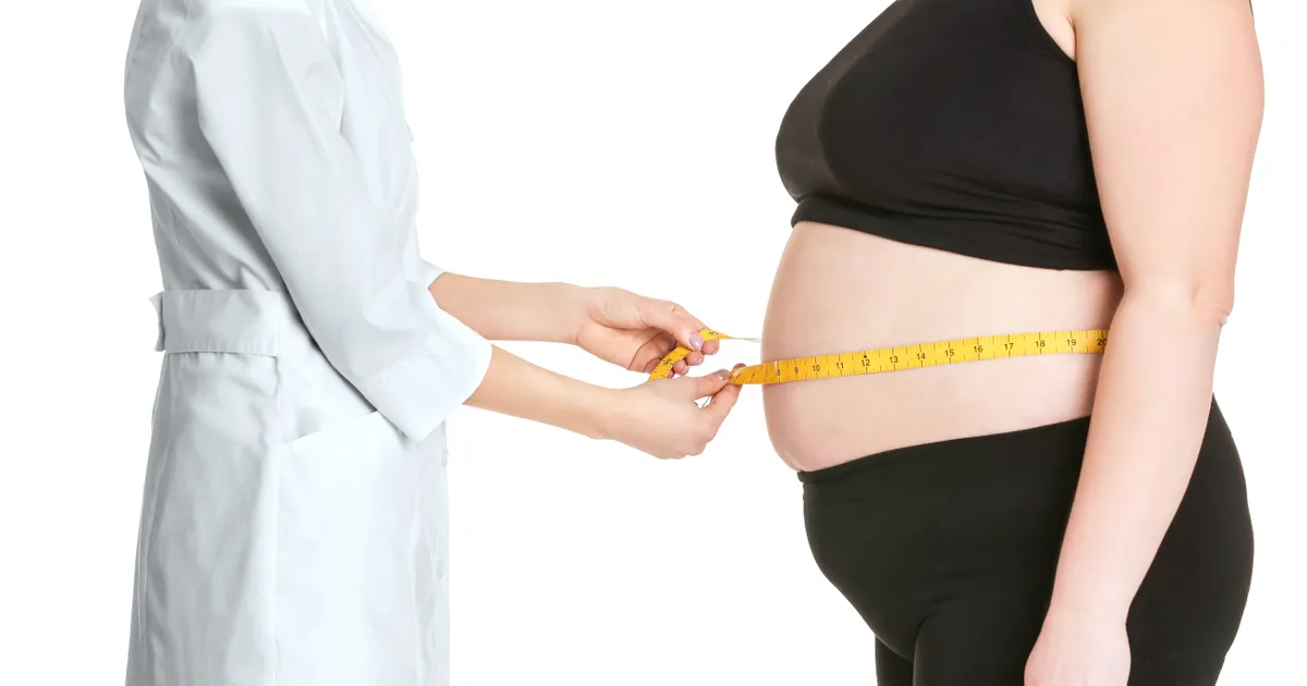 Gastric Sleeve Surgery Comparing Costs and Insurance Coverage at