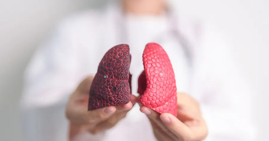 Understanding Lung Cancer Treatment: Options and Approaches