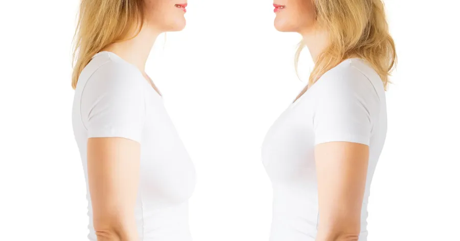 How the Vampire Breast Lift Works: Benefits and Costs Explained