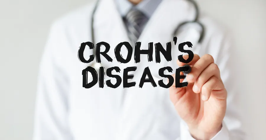 Taming Crohn’s Disease: Affordable Treatments and Support Networks