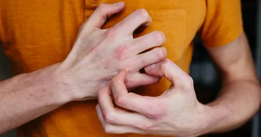 Unmasking the Hidden Signs of Atopic Dermatitis