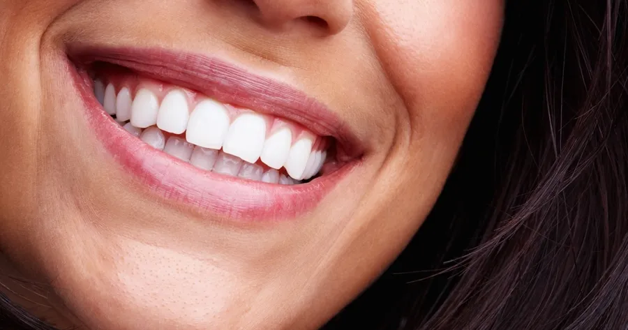 Top Teeth Whitening Solutions That Work