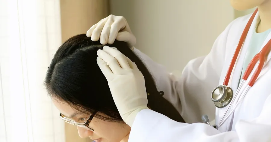 Signs of Scalp Psoriasis and Ways You Can Treat it