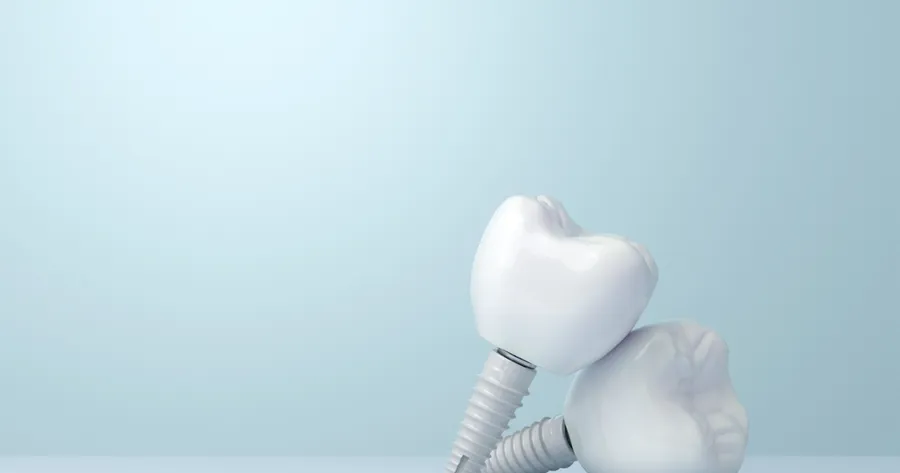 The Benefits of Zirconia Dental Implants Over Alternatives