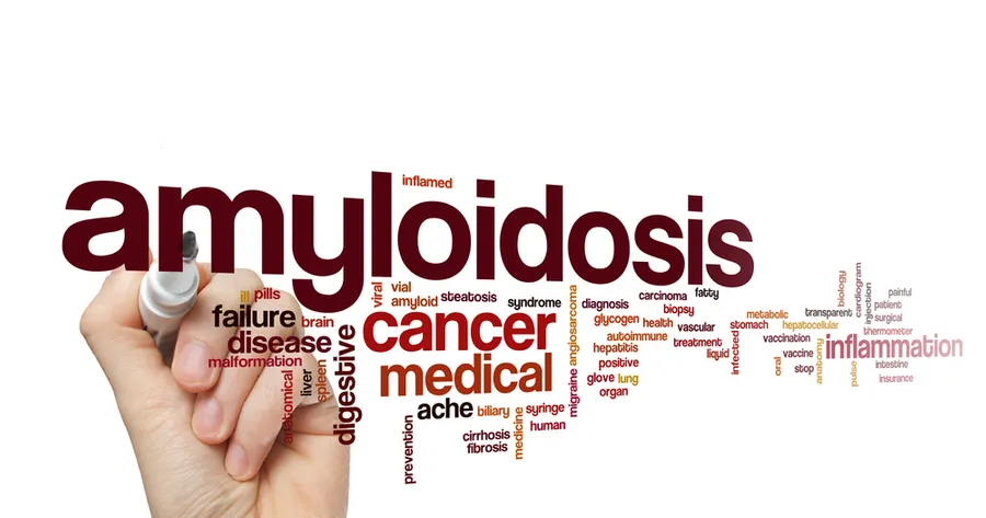 Recognizing the Symptoms of Amyloidosis and Why Early Detection is Essential