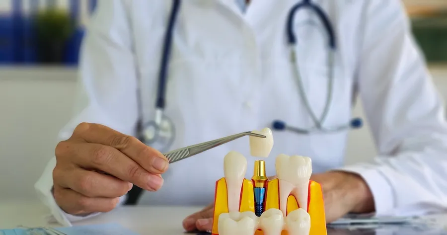 Dental Implant Clinical Trials: New Treatments & Technology