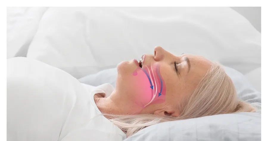 Sleep Apnea Solutions: Breathe Better, Sleep Better