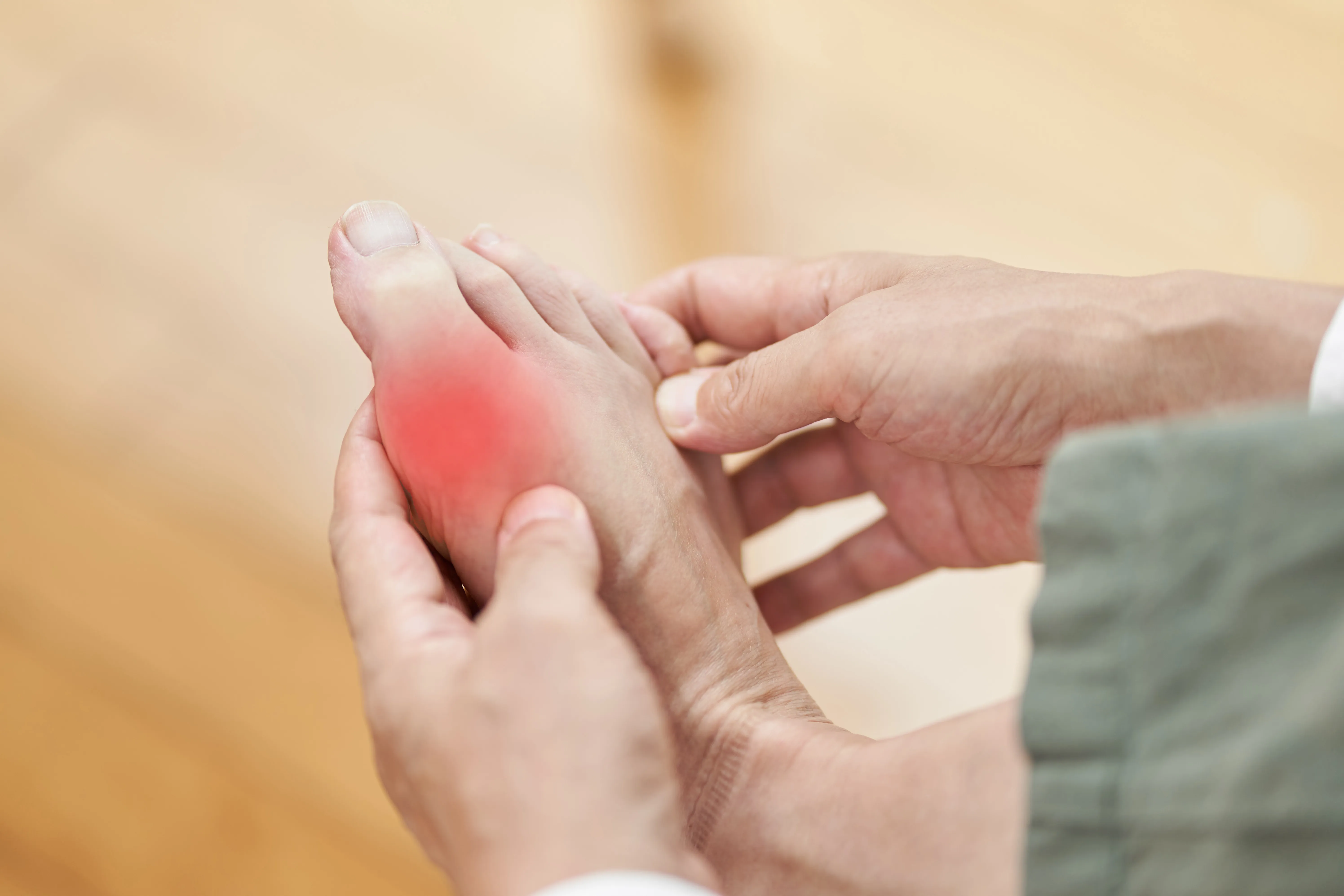 A Guide to Identifying Gout Symptoms