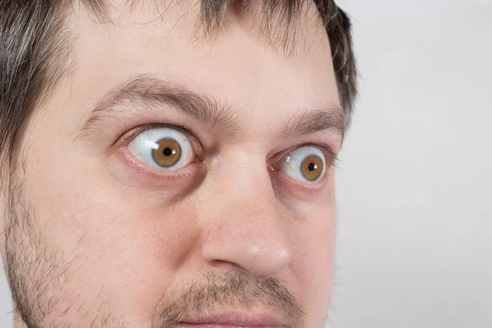 First Signals of Thyroid Eye Disease and Infusion Treatments