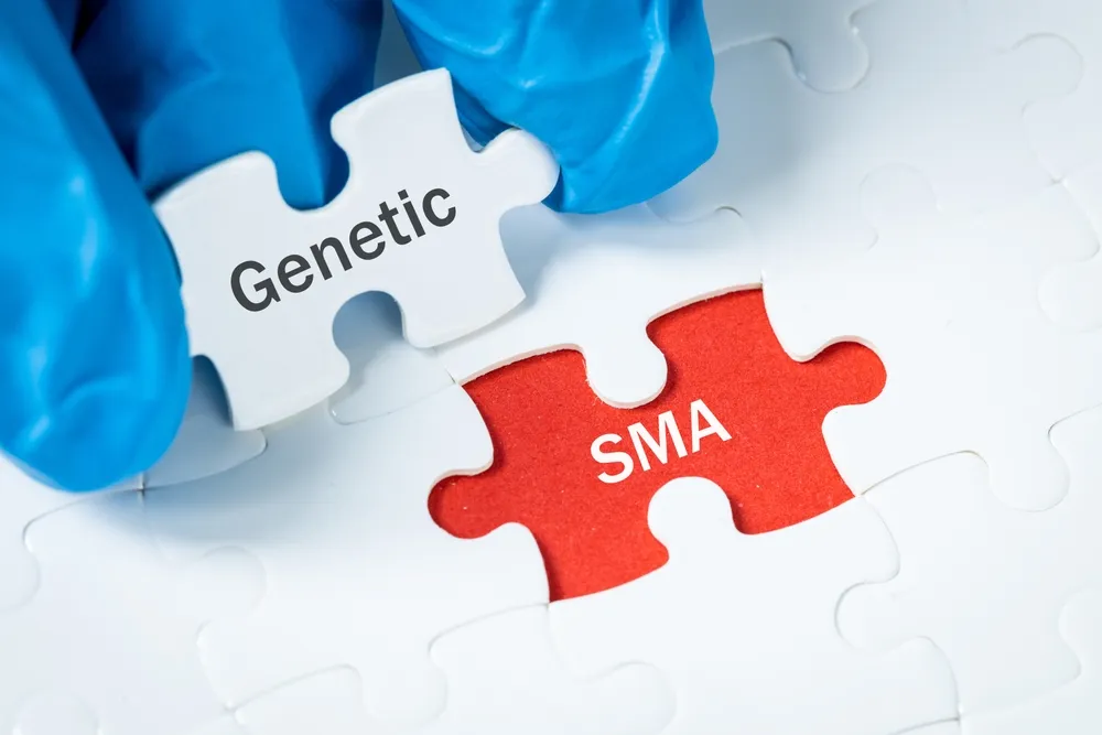 Do You Have SMA? Try This New Treatment