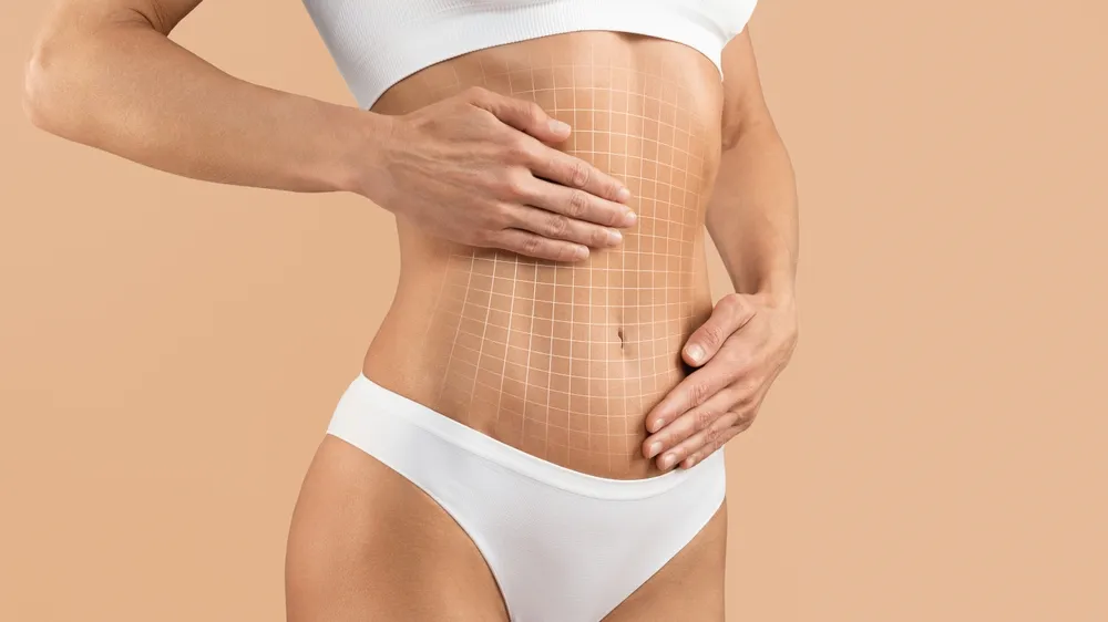 Get a Tummy Tuck for Less with a Mini Tuck: A Cost-Effective Solution for a Flatter Stomach