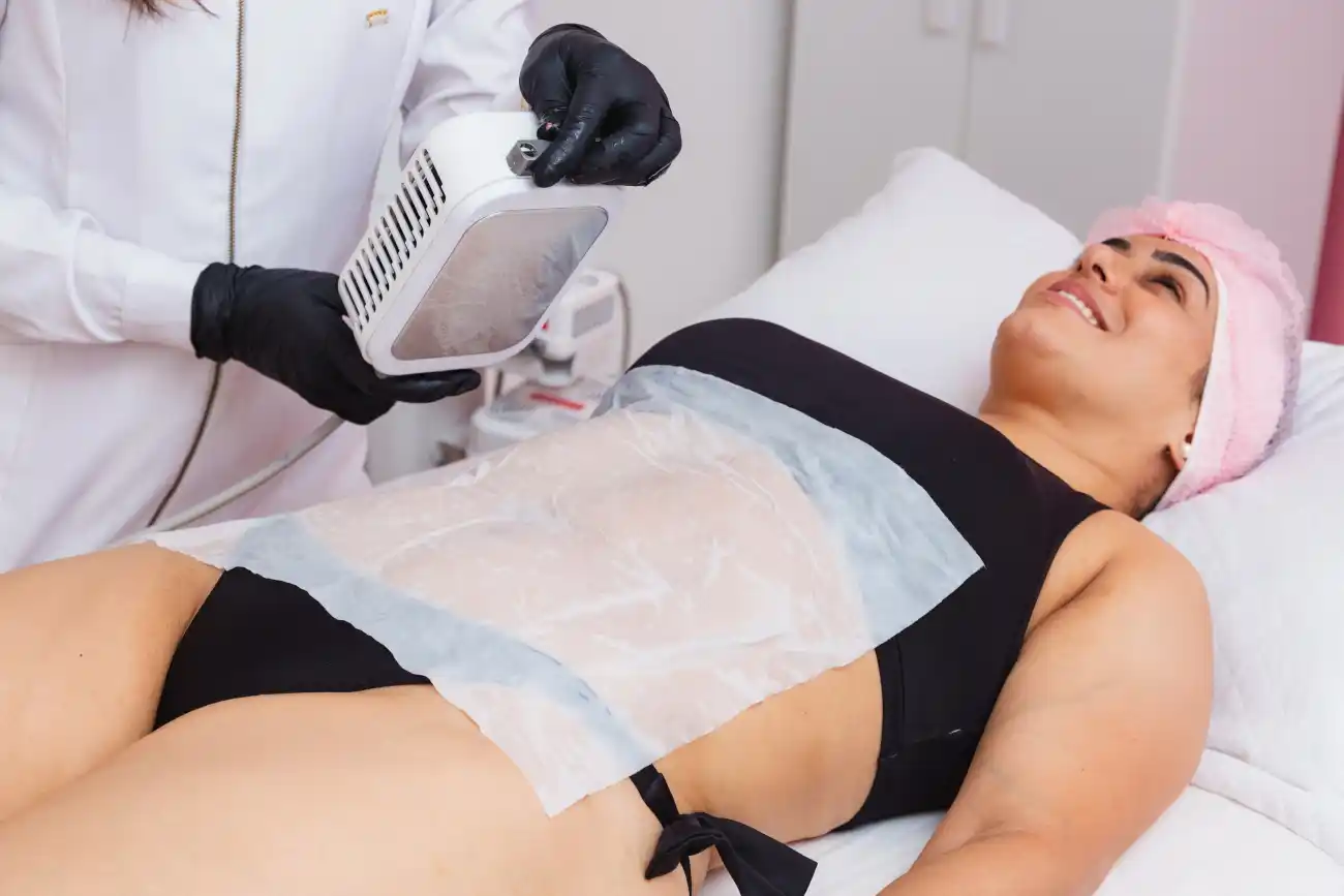 Want a Flawless Body? Here’s How Coolsculpting Can Help