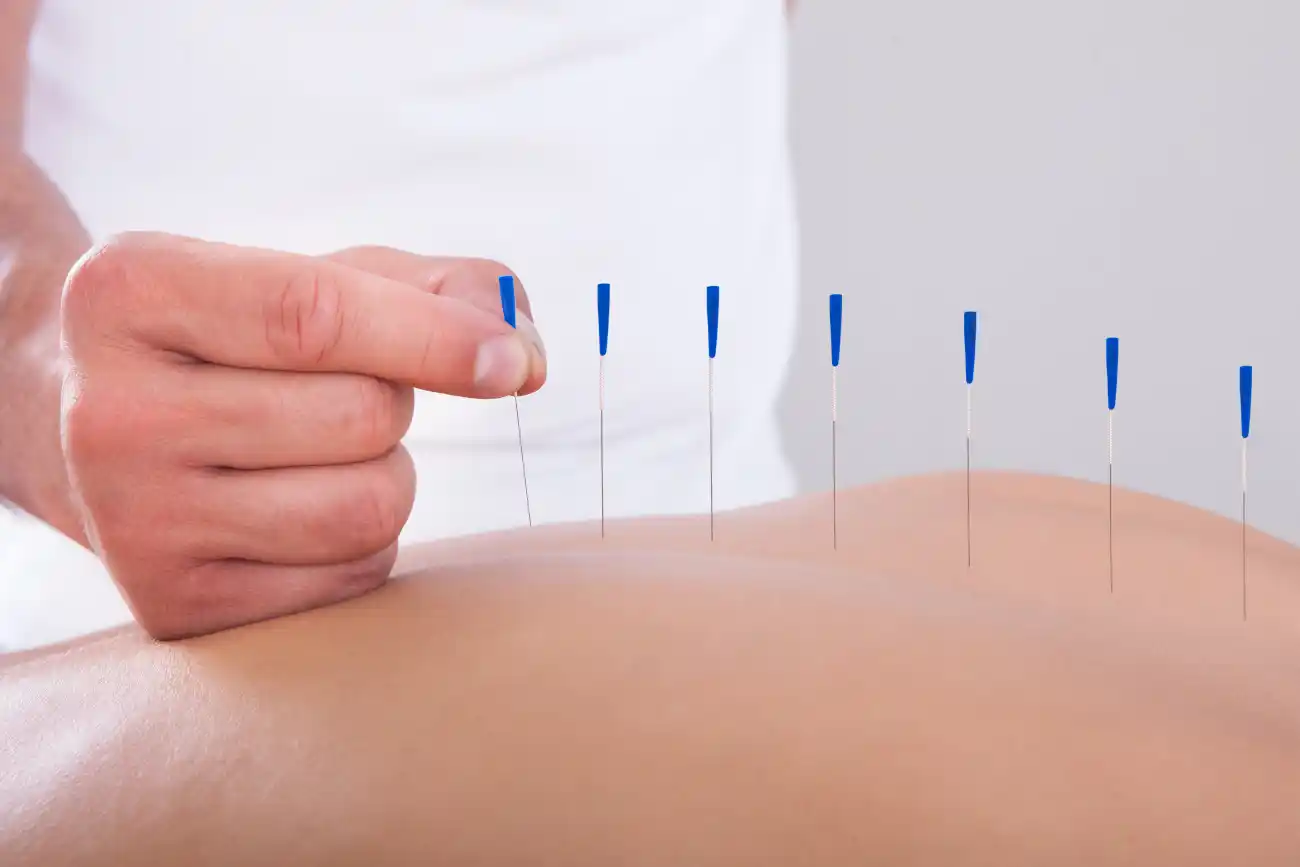 Earning Your Acupuncture Certification Online Without Breaking the Bank